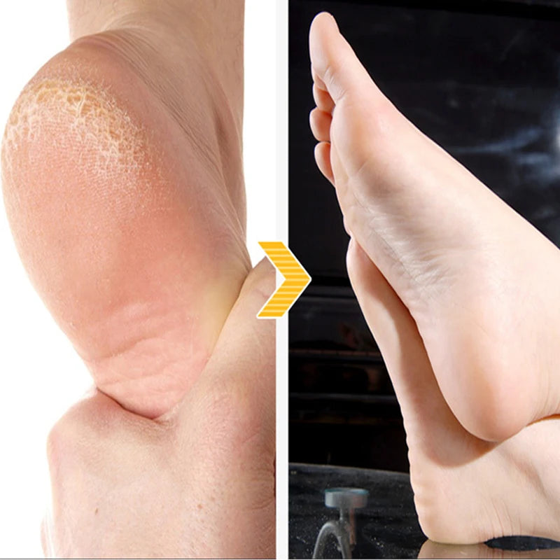 2packs=4pcs Foot Peeling Mask Renewal Foot Mask for Legs Remove Dead Skin Smooth Exfoliating Socks Foot Care Socks For Pedicure