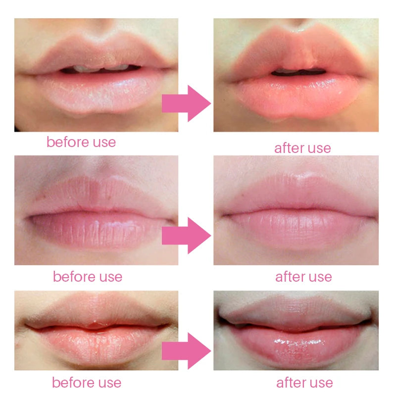 5/8Pcs Lip Plumper Crystal Collagen Lip Mask Pads Moisture Essence Anti Ageing Wrinkle Patch Pad Gel Scrub Lips Care Enhancer