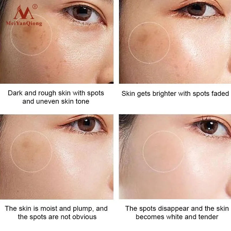 Dark Spot Remover Cream Skin Lightening Cream Dark Skin Care Anti Freckle  Whitening Cream  Anti Aging Face Care